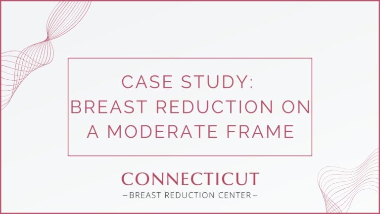 Case Study: Breast Reduction on a Moderate Frame