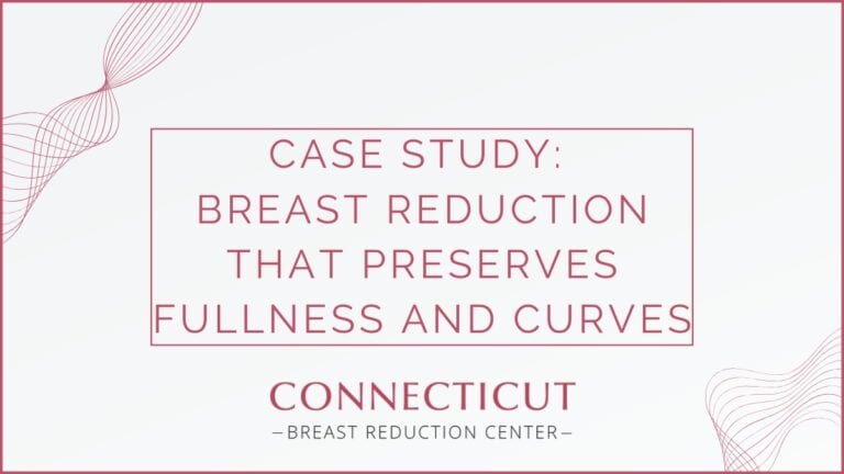 Case Study: Breast Reduction That Preserves Fullness and Curves